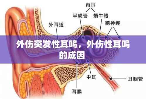 外伤突发性耳鸣,外伤性耳鸣的成因