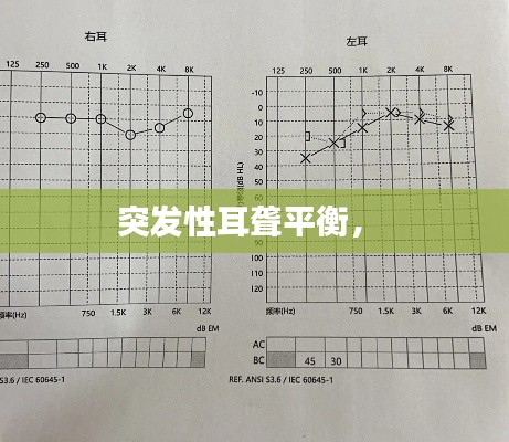 突发性耳聋平衡， 